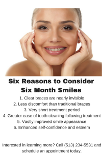 6 Reasons to Use Six Month Smiles